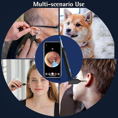 Ear Wax Removal, Wireless Ear Cleaner Ear Cleaning Kit with 7 Pcs Ear Pick Set, Wax Elimination Spoon Kit with 6 Soft Silicone Ear Scoops, Ear Wax Removal Tool for Smartphones